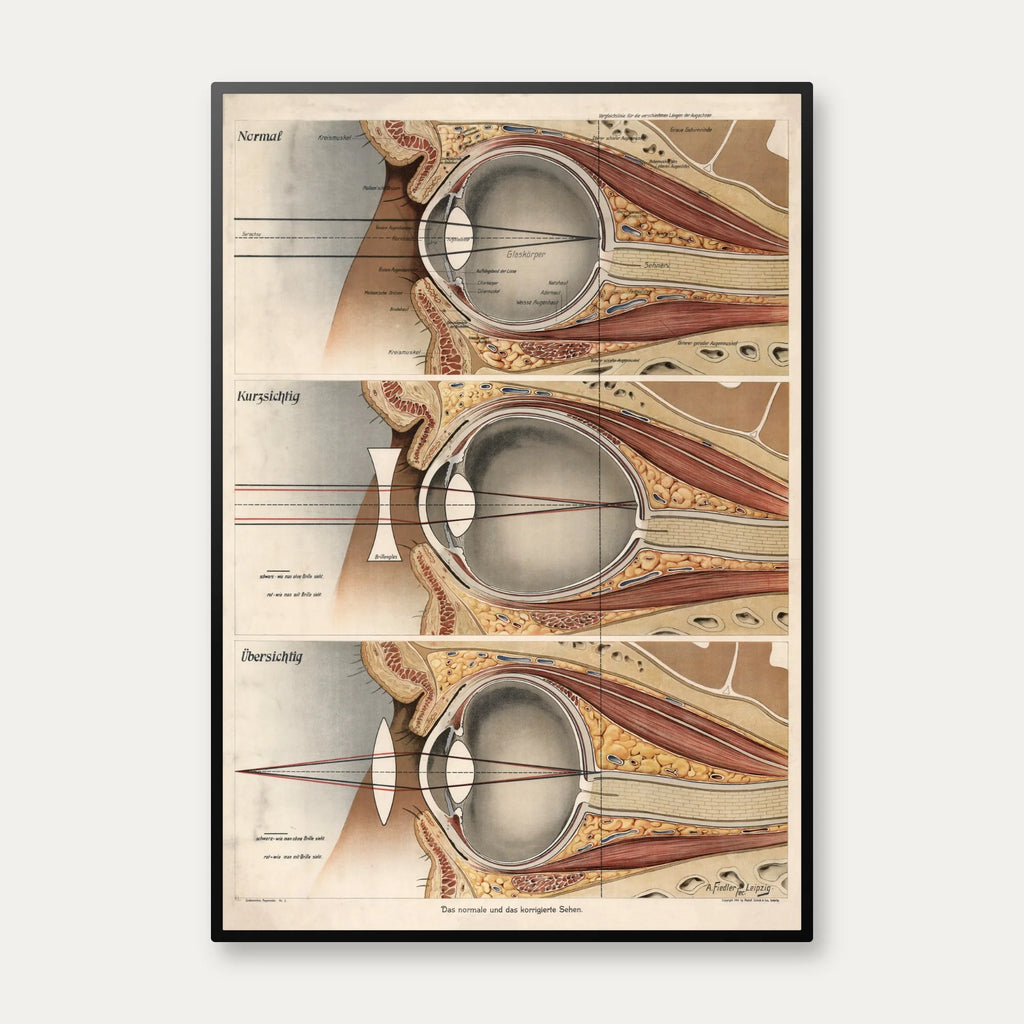 Øjet 1916 - Anatomisk planche – billede 1