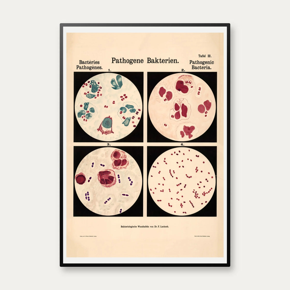 Gonorré-bakterier 1909 - Biologi – billede 1